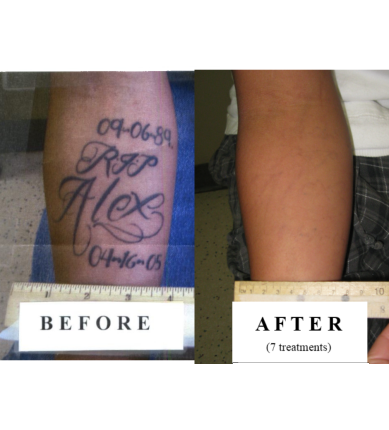TakeAwayTattoo